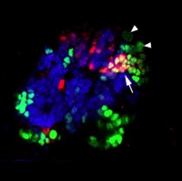 Neural stem cells