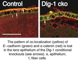 A diagram comparing the differences in epithelium and fiber cells.
