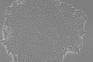A gray diagram of iPSCs - human-induced pluripotent stem cells. 