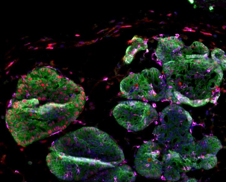 A cluster of green cells with purple and red dots on a black background. 