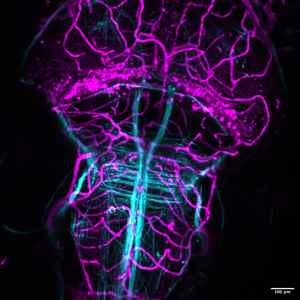 A 6 day old (6 days post fertilization (dpf)) live zebrafish brain. Magenta marks blood cells moving through the brain vascular system, and cyan marks myelin basic protein (mbp) (oligodendrocytes and Schwan cells).