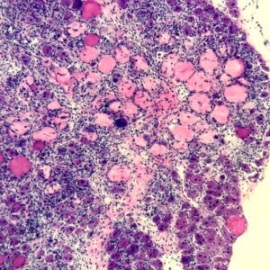 Pink and purple cell diagram showing a muscle stem cell isolated from a dead human aged 60+ years as the cells survive post-mortem
