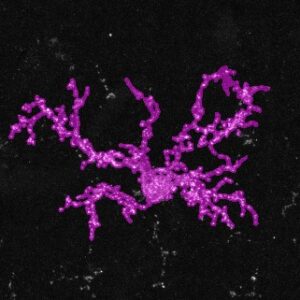 A purple brain tissue sample on a black background; segmentation of a dystrophic microglia in human brain tissue impacted by Alzheimer's disease.